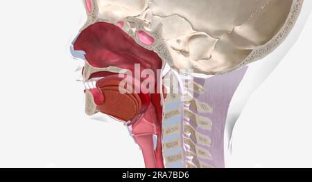 Anaphylaxis is a severe, systemic allergic reaction characterized by ...