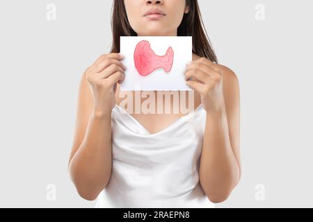 Illustration of the goitre in the white paper is on the woman's throat. Stock Photo