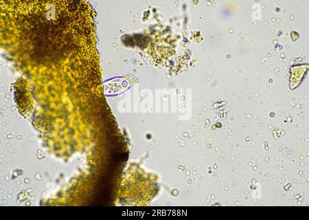 soil microbes organisms in a soil and compost sample, fungus and fungi and under the microscope in regenerative agriculture Stock Photo