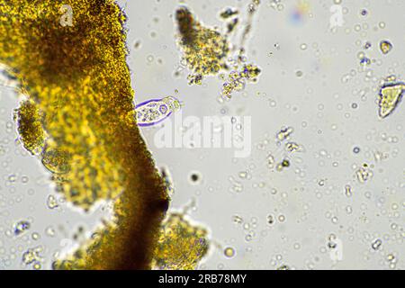 soil microbes organisms in a soil and compost sample, fungus and fungi and under the microscope in regenerative agriculture Stock Photo