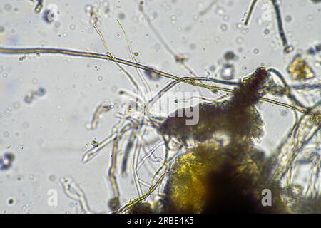 fungal hyphae under the microscope in a test Stock Photo - Alamy