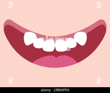 Cartoon smiling mouth with teeth crowding. Double tooth. Abnormal eruption. Cute hand drawn smile. Vector illustration Stock Vector