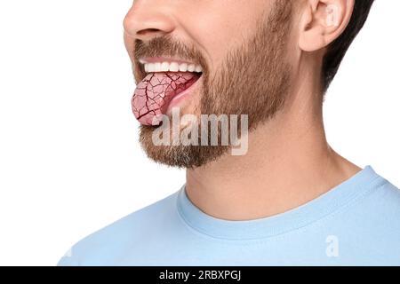 Dry mouth symptom. Man showing dehydrated tongue on white background ...