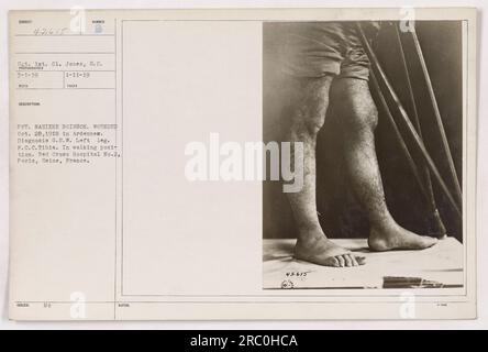 Left leg hi-res stock photography and images - Alamy
