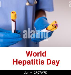 Composition of world hepatitis day text over biracial female doctor holding test tubes Stock Photo