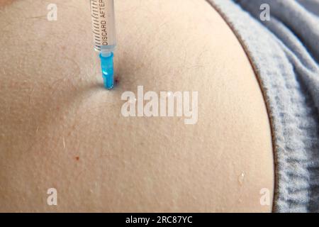 Needle injecting into the muscle. Nurse doing a trigger point injection in patient back. Close up doctor makes an shot therapy. Alternative pain treat Stock Photo