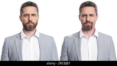 Collage with photos of man before and after lips augmentation on white ...