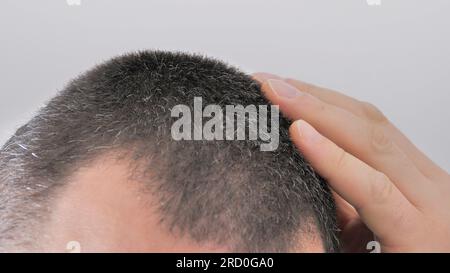 a man touches his hair with gray hairs Stock Photo