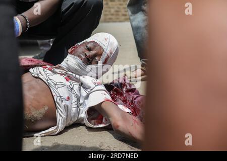 Nairobi, Kenya. 19th July, 2023. (EDITORS NOTE: Image contains graphic content) A boy who was shot by a stray bullet on the head during the demonstration called by Azimio Party leader Raila Odinga over high cost of living receives medical attention in Mathare Slums. (Photo by John Ochieng/SOPA Images/Sipa USA) Credit: Sipa USA/Alamy Live News Stock Photo