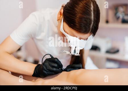 Doctor is doing electroepilation to the client using electro