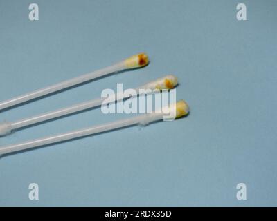 Dirty cotton swabs. Earwax on cotton swabs. Personal hygiene. Dirt from the ears. Medicine. Hygiene accessories. Discharge . Ear cleaning concept Stock Photo