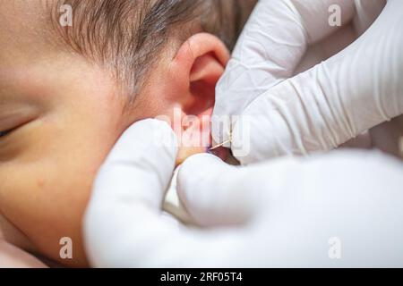 Piercing a newborn's ear to put an earring Stock Photo