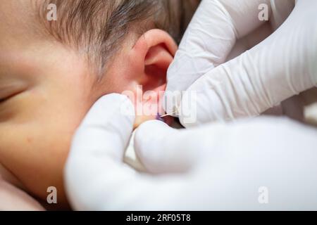 Piercing a newborn's ear to put an earring Stock Photo