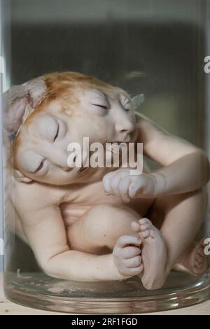 April 1, 2023 - Gomel: fully plastinated Siamese twins at an anatomical exhibition with plastinated cadavers. Embalmed Siamese twins. Stock Photo