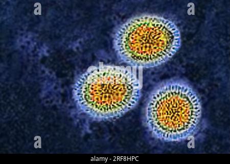 Influenza virus of the Orthomyxoviridae family (respiratory viral infection). Transmission electron microscopy, viral diameter 80 to 120 nanometers. Stock Photo
