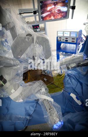 Urology department of a hospital performing prostatectomies using a robot surgeon. Stock Photo