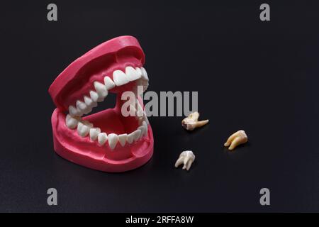 Dental layout of the human jaw with teeth and implants Stock Photo - Alamy