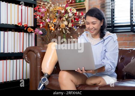 Young asian woman disabled sitting on sofa using laptop computer with prosthetic leg in living room at home, female working on notebook and prosthesis Stock Photo