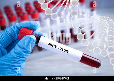 Noninvasive prenatal testing (NIPT). Nurse holding test tube with blood sample in laboratory, closeup. Illustration of DNA structure Stock Photo