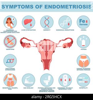 Symptom of endometriosis reproductive disease vector illustration Stock Vector