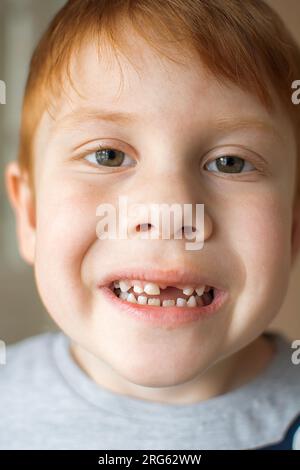 Portrait of a red-haired six-year-old boy without a front tooth. A child's smile without an upper tooth Stock Photo