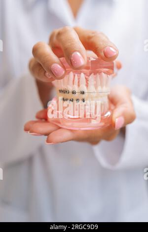 Vertical detail cropped shot of unrecognizable female orthodontist doctor in white coat holding human jaws layout model with metal dental braces Stock Photo