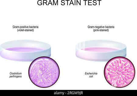 Gram stain test. glass Petri dish with culture Gram-negative bacteria Escherichia coli after used of crystal violet stain. Close-up of Gram-positive Stock Vector