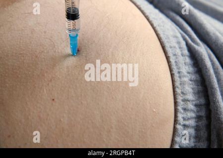 Needle injecting into the muscle. Nurse doing a trigger point injection in patient back. Close up doctor makes an shot therapy. Alternative pain treat Stock Photo