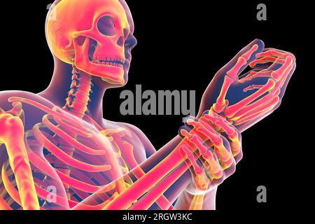 Wrist pain, illustration Stock Photo