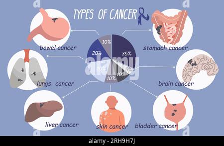 Cancer patient oncology flat infographic composition with radial chart and round compositions representing types of cancer vector illustration Stock Vector