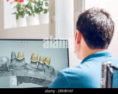 Back view of unrecognizable male prosthetist using computer program for creating 3d model of jaw implants Stock Photo