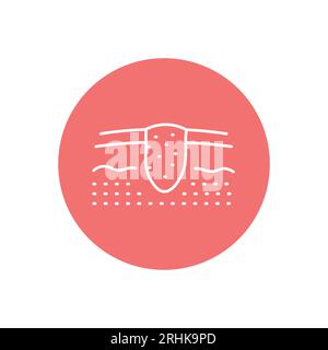 Skin cancer black line icon. Dermatology disease. Skin problem Stock Vector
