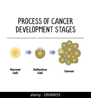 process of cancer development stages illustration isolated on white background. Stock Vector