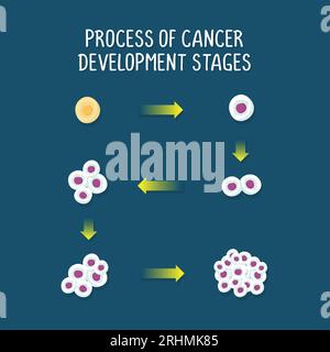 process of cancer development stages illustration isolated on dark background. Stock Vector