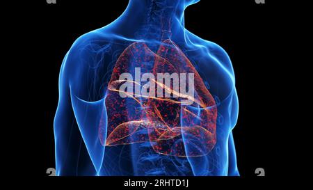 Lung infection, illustration Stock Photo