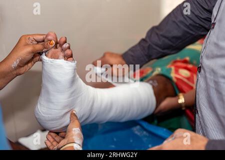 A doctor and nurse are applying a plaster cast to the leg of an elderly woman Stock Photo