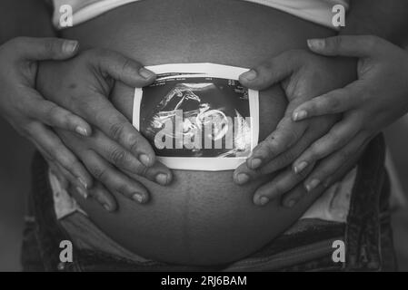 A pregnant couple with an ultrasound image on the woman's belly Stock Photo