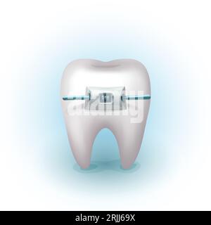 a realistic human white tooth with braces Stock Vector