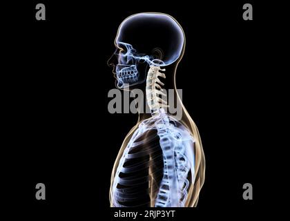 x-ray side view of cervical section of spine Stock Photo