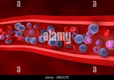 Acute myeloid leukemia (AML) cells in blood flow - isometric view 3d illustration Stock Photo