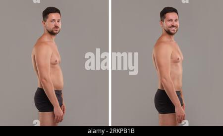 Collage with portraits of man before and after weight loss on grey background Stock Photo
