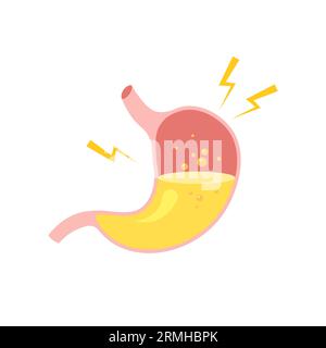 Sick human stomach in trendy flat style. Nutrition, stomach pain, bloating. Digestive system anatomy. Vector illustration isolated on white background Stock Vector