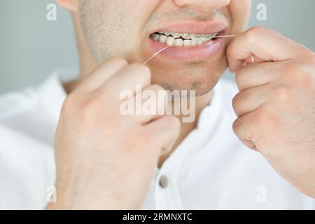 Handsome young man with braces cleaning his teeth with dental floss Stock Photo