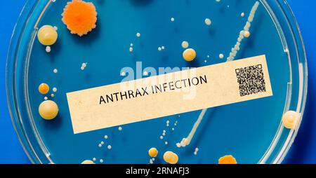 Anthrax - Bacterial infection that can cause skin, lung, and gastrointestinal illness. Stock Photo