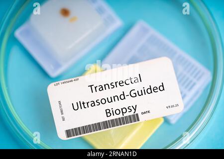 Transrectal ultrasound-guided biopsy. This involves the insertion of a needle into the prostate gland through the rectum to obtain a tissue sample for Stock Photo