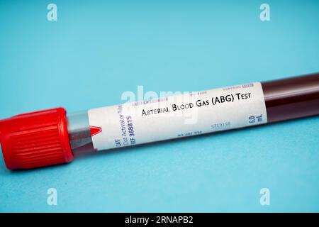 Arterial Blood Gas ABG Medical check up test tube with biological ...