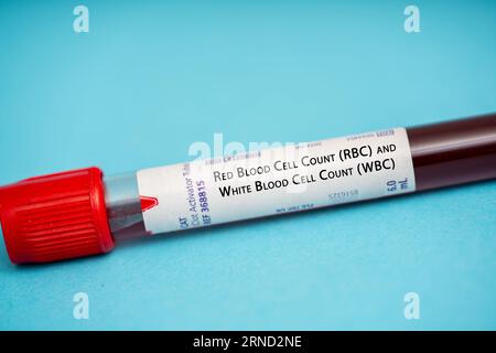 White Blood Cell (WBC) Count Test A blood test to evaluate immune ...