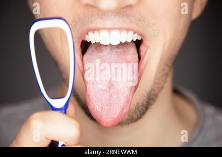 white covered and coated tongue out with tiny bumps is indicator for sickness and infections and reason for bad breath and smell but can be cleaned by Stock Photo
