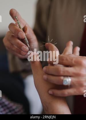 (170120) -- BEIJING, Jan. 20, 2017 -- A Palestinian acupuncturist inserts an acupuncture needle into a patient s finger in Gaza City on May 7, 2013. Chinese President Xi Jinping presented a bronze acupuncture statue on Jan. 18, 2017 to the World Health Organization (WHO) in Geneva, Switzerland, which shows acupuncture points on the human body. According to the WHO, 103 members have given approval to the practice of acupuncture and moxibustion, with 29 having enacted special statutes on traditional medicine, and 18 having included acupuncture and moxibustion treatment in their medical insurance Stock Photo