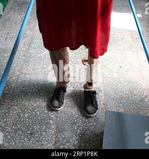 (180718) -- KABUL, July 18, 2018 -- An Afghan disabled woman stands with her prosthetic leg at the Orthopedic Center of the International Committee of the Red Cross in Kabul, capital of Afghanistan, July 18, 2018. Up to 1,692 Afghan civilians were killed as a result of conflicts and terrorist attacks in the first half of this year, hitting a record high, a UN mission said on Sunday. ) (rh) AFGHANISTAN-KABUL-ORTHOPEDIC CENTER RahmatxAlizadah PUBLICATIONxNOTxINxCHN Stock Photo